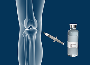 Combined Hyaluronic Therapy for the Knee