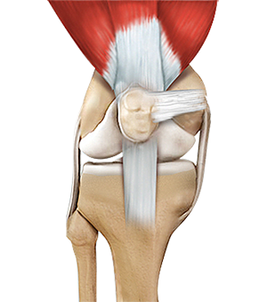 Women and ACL Injuries