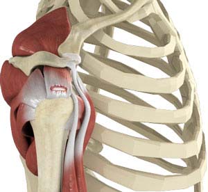 Rotator Cuff Re-tear